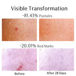 Clarifying Moisturizer for Men (2 Fl Oz/60ml)