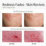 Oil-Control Toner (4 Fl Oz/120ml)