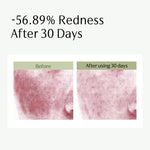 Centella Asiatica Repairing Face Serum (1.18 Fl Oz/35ml)